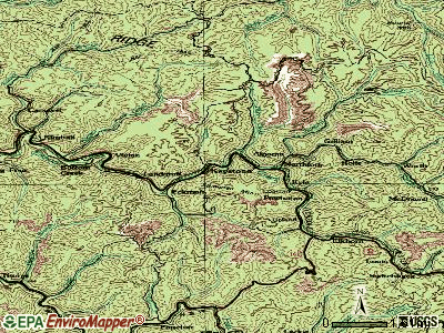Dialysis technician employment fresenius dialysis machine fee