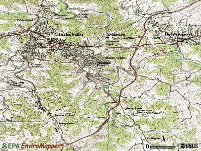 Stonewood topographic map