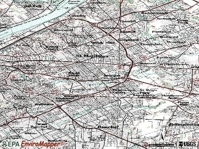kidney transplant joint ache